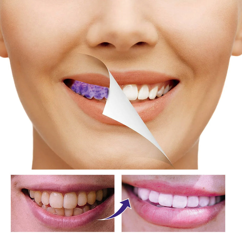 Teeth Whitening Mousse Toothpaste